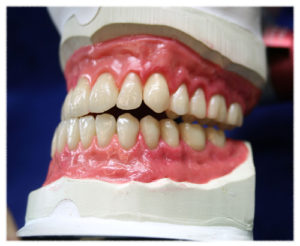 dentures by franklin parada