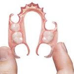 tcs  Thermosens & Flexible TCS Dentures 