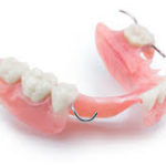 Acrylic Partial Dentures